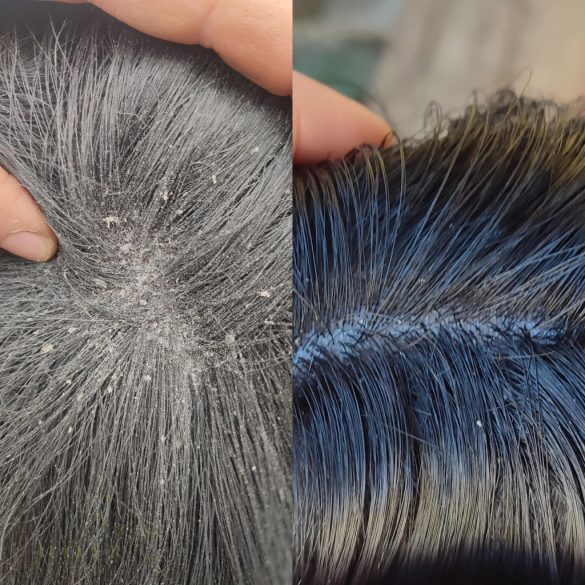 CXEVALO - SZŐRÁPOLÓ SPRAY  500 ml - ERŐS FÉNYES SZŐRZETÉRT /nyári ekcéma, viszketés vagy irritált bőr kezelésére/